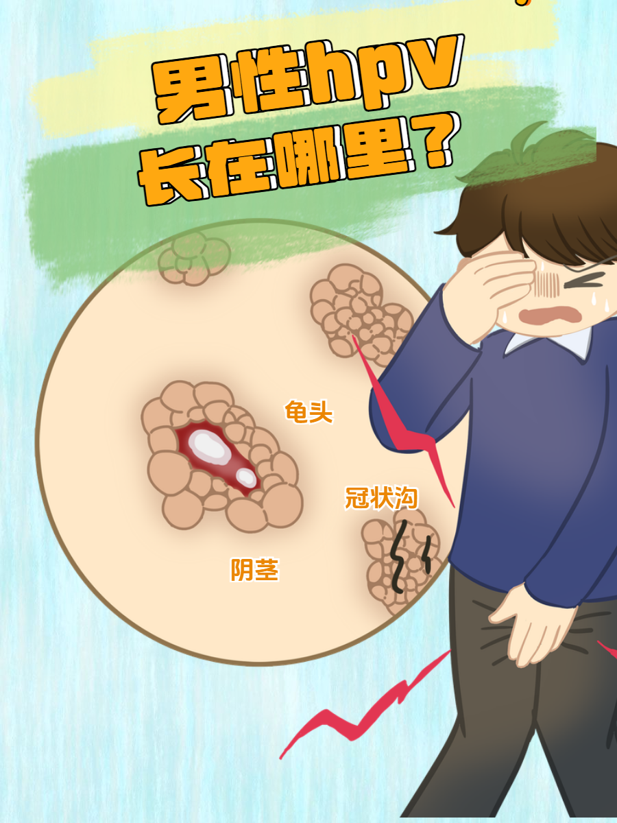 中国首个男性HPV防控倡议发布 首次将男性置于我国HPV防控战略前沿