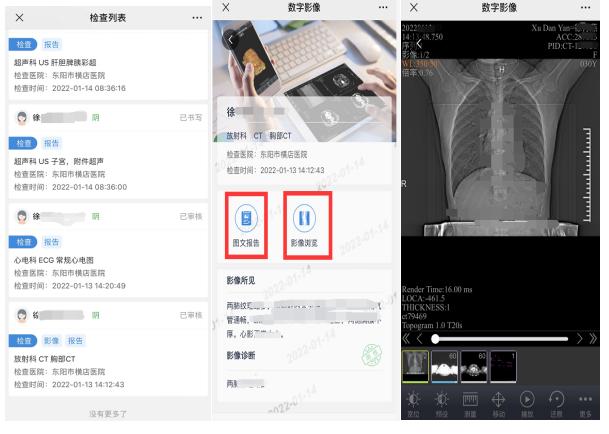 医保影像云跨省调阅启动 医学影像开始实现全国“漫游”